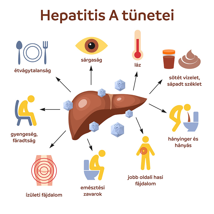 Hepatitis A tünetei